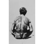 Scars on the back of an Aboriginal man in the North West.